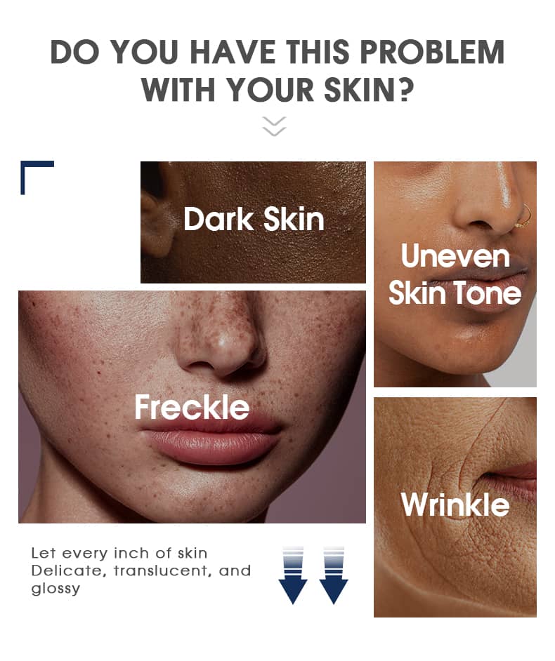 glutathione supplements for skin whitening Amazon.com: Glutathione Whitening Pills - 120 Capsules 2000mg Glutathione -  Effective Skin Lightening Supplement - Dark Spots, Melasma & Acne Scar  Remover, Hyperpigmentation Treatment